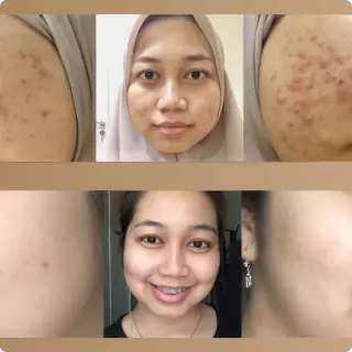 rizkiana sholehah 09113140473