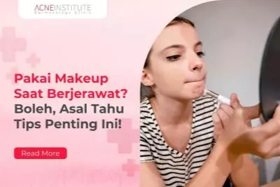Pakai Makeup Saat Berjerawat? Boleh, Asal Tahu Tips Penting Ini!