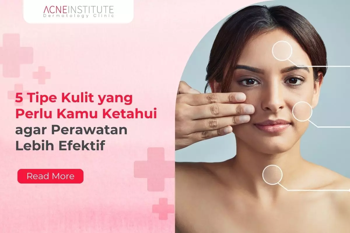5 Tipe Kulit yang Perlu Kamu Ketahui agar Perawatan Lebih Efektif