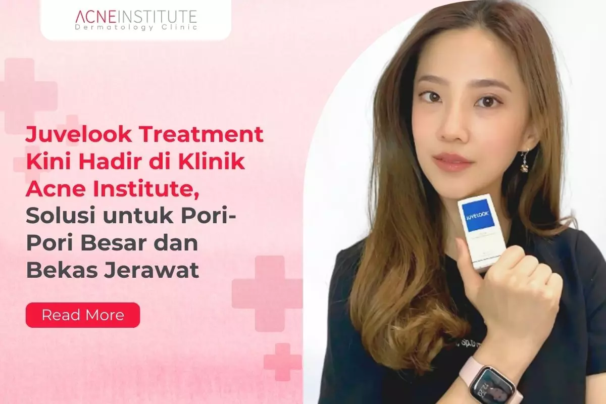 Juvelook Treatment Kini Hadir di Klinik Acne Institute, Solusi untuk Pori-Pori Besar dan Bekas Jerawat