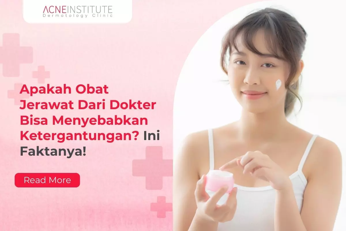 Apakah Obat Jerawat Dari Dokter Bisa Menyebabkan Ketergantungan? Ini Faktanya!