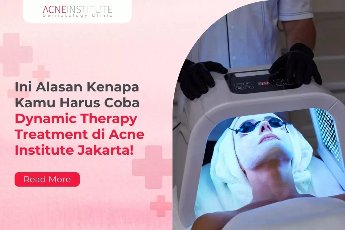 Ini Alasan Kenapa Kamu Harus Coba Dynamic Therapy Treatment di Acne Institute Jakarta!