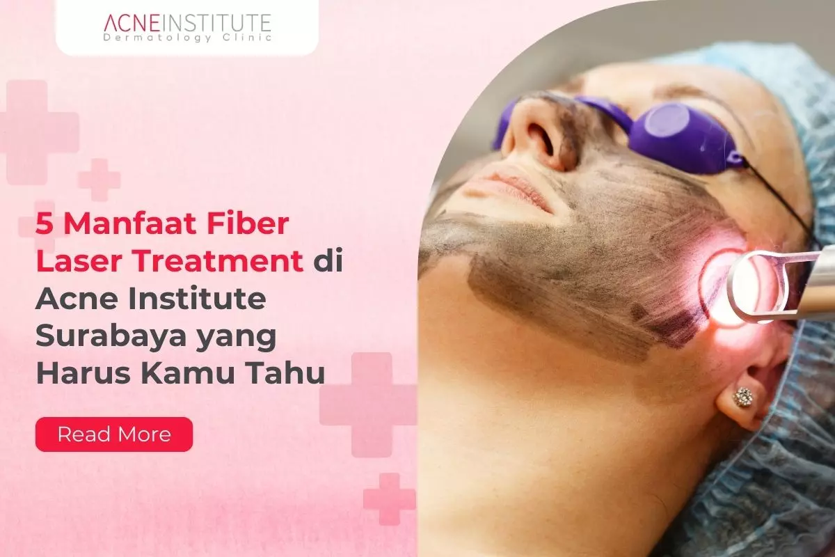 5 Manfaat Fiber Laser Treatment di Acne Institute Surabaya yang Harus Kamu Tahu