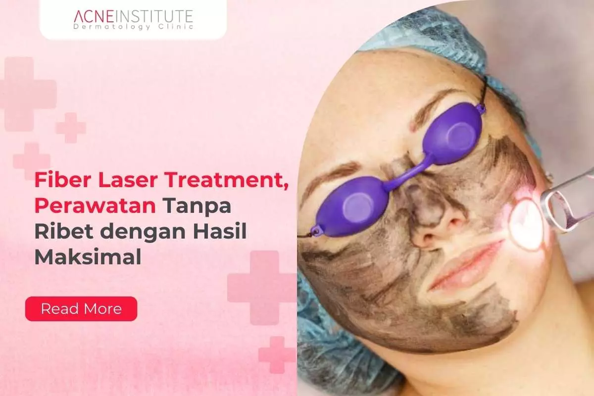 Fiber Laser Treatment, Perawatan Tanpa Ribet dengan Hasil Maksimal