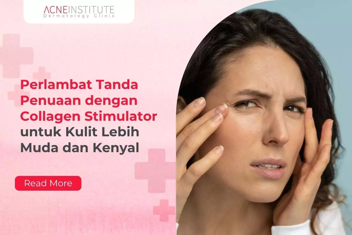 Perlambat Tanda Penuaan dengan Collagen Stimulator untuk Kulit Lebih Muda dan Kenyal