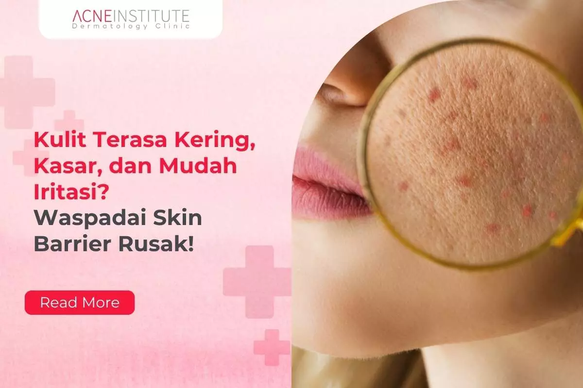 Kulit Terasa Kering, Kasar, dan Mudah Iritasi? Waspadai Skin Barrier Rusak!