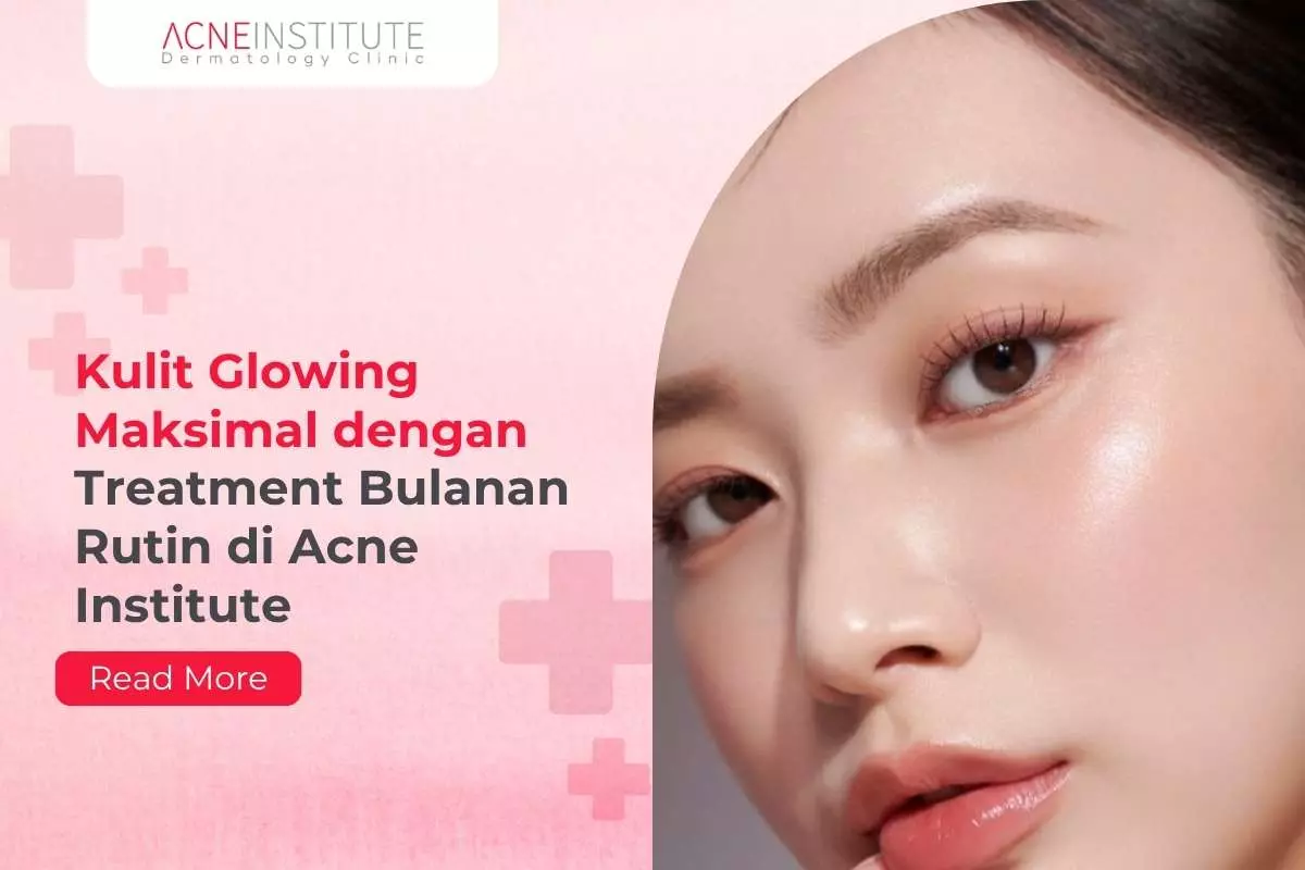 Kulit Glowing Maksimal dengan Treatment Bulanan Rutin di Acne Institute