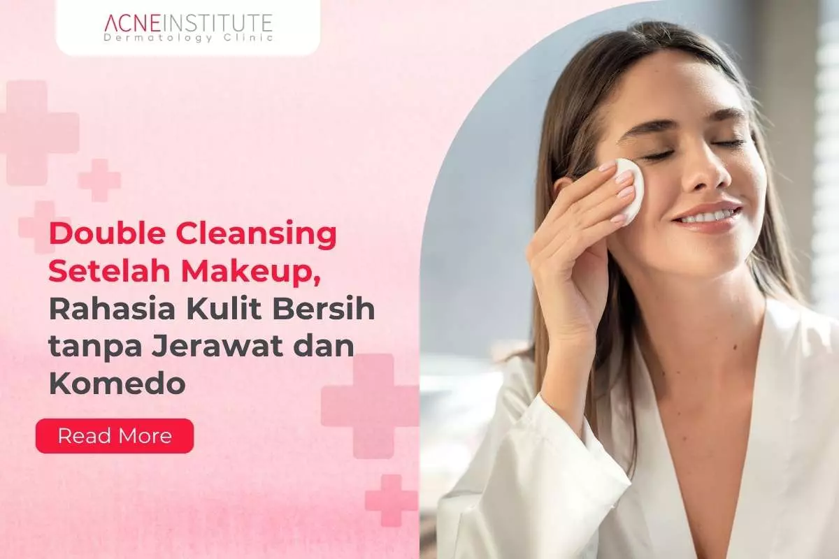 Double Cleansing Setelah Makeup, Rahasia Kulit Bersih tanpa Jerawat dan Komedo