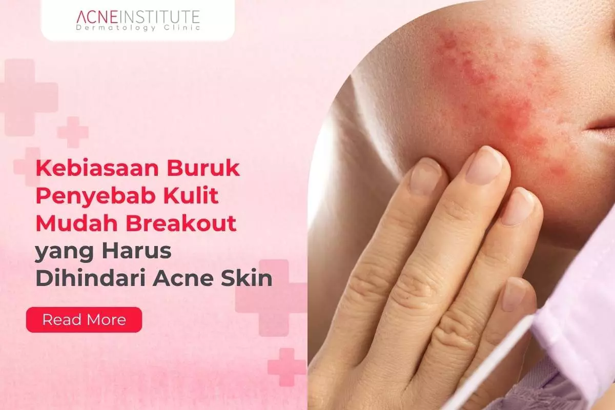 Kebiasaan Buruk Penyebab Kulit Mudah Breakout yang Harus Dihindari Acne Skin