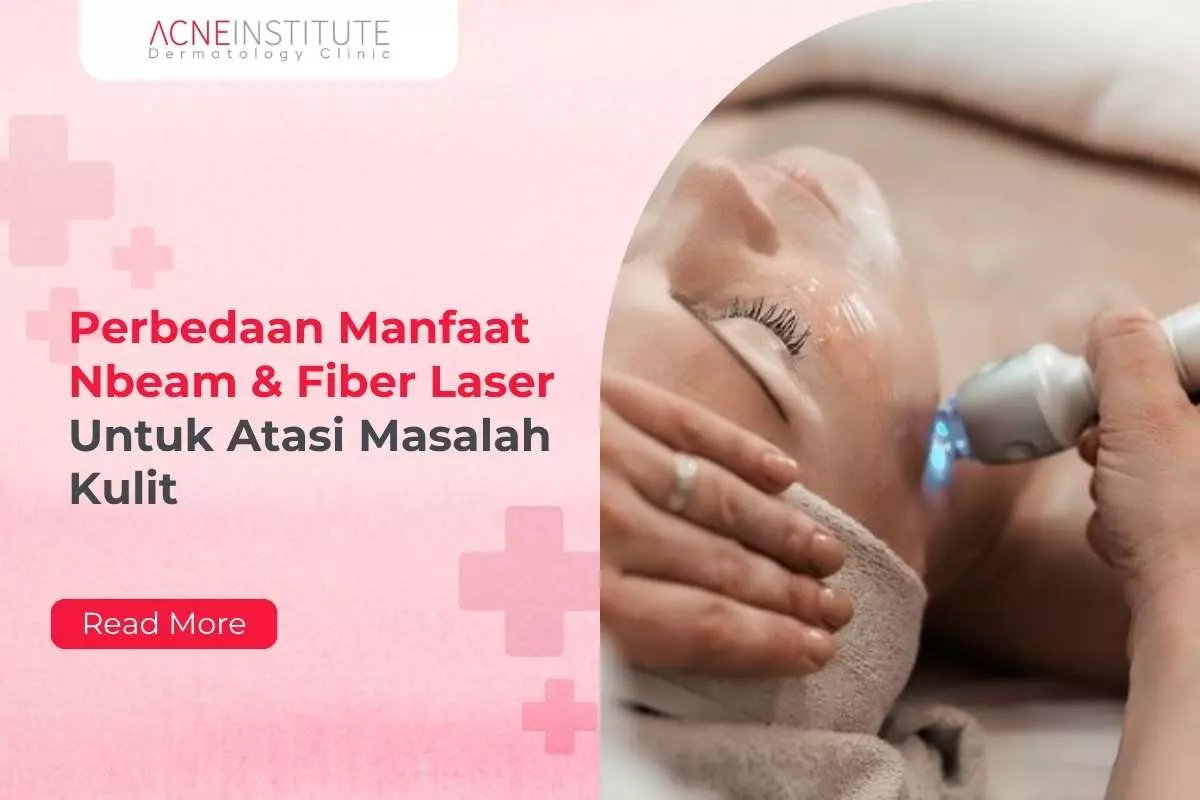 Perbedaan Manfaat Nbeam & Fiber Laser Untuk Atasi Masalah Kulit