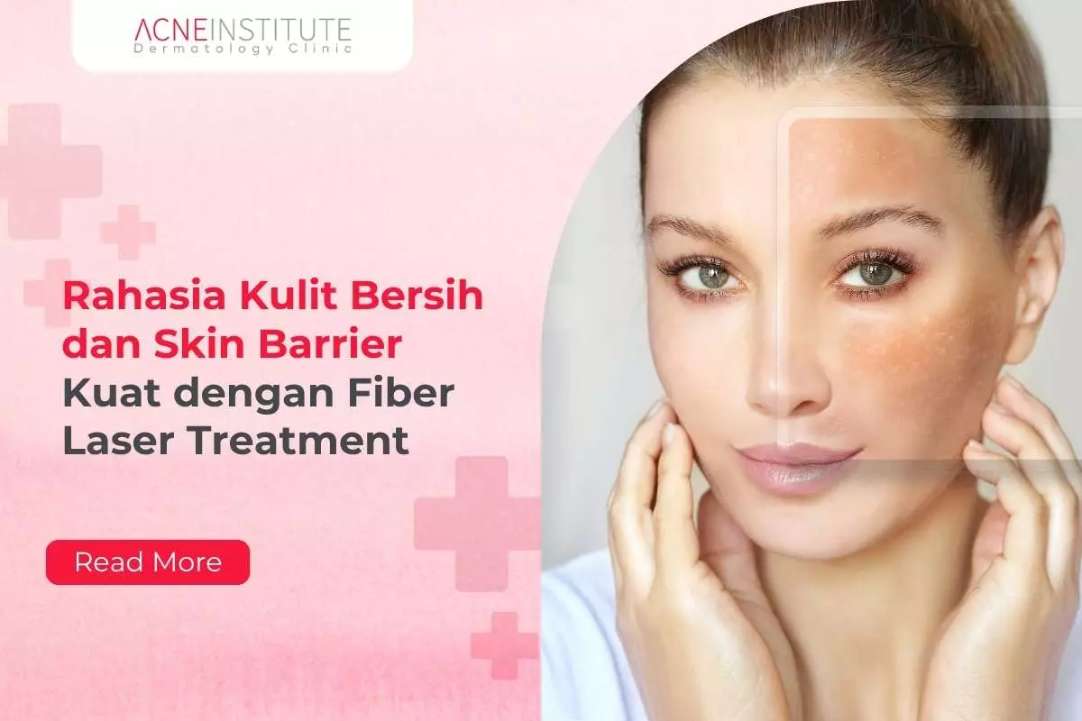 Rahasia Kulit Bersih dan Skin Barrier Kuat dengan Fiber Laser Treatment