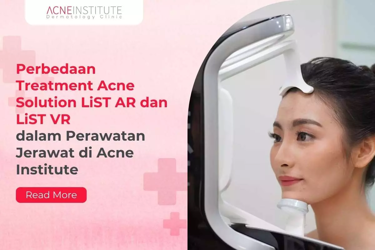Perbedaan Treatment Acne Solution LiST AR dan LiST VR dalam Perawatan Jerawat di Acne Institute