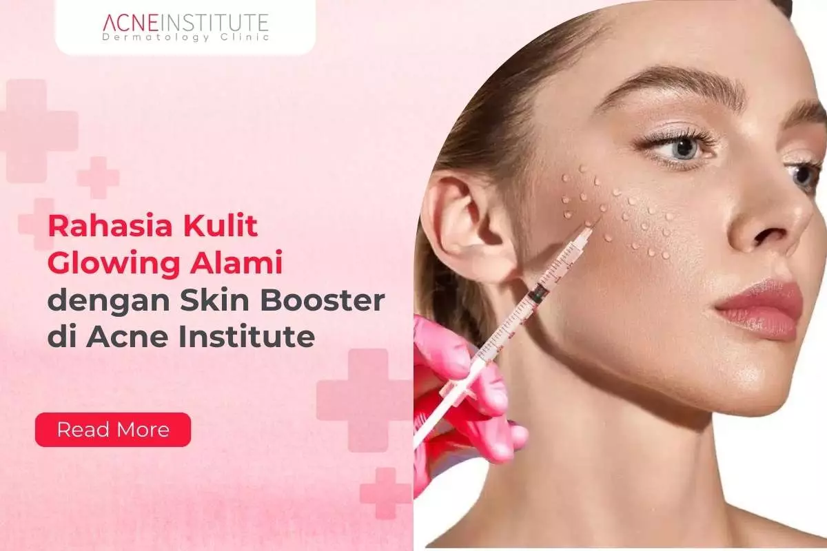 Rahasia Kulit Glowing Alami dengan Skin Booster di Acne Institute