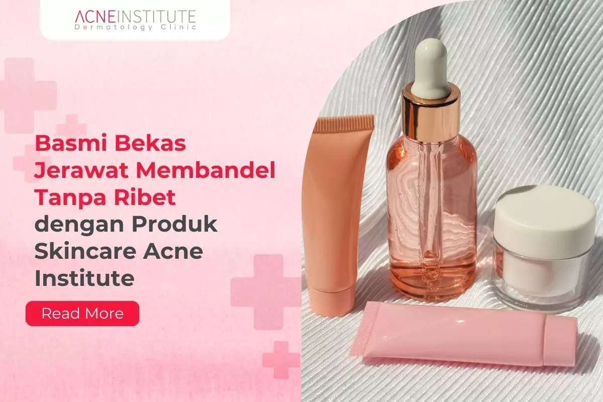 Basmi Bekas Jerawat Membandel Tanpa Ribet dengan Produk Skincare Acne Institute