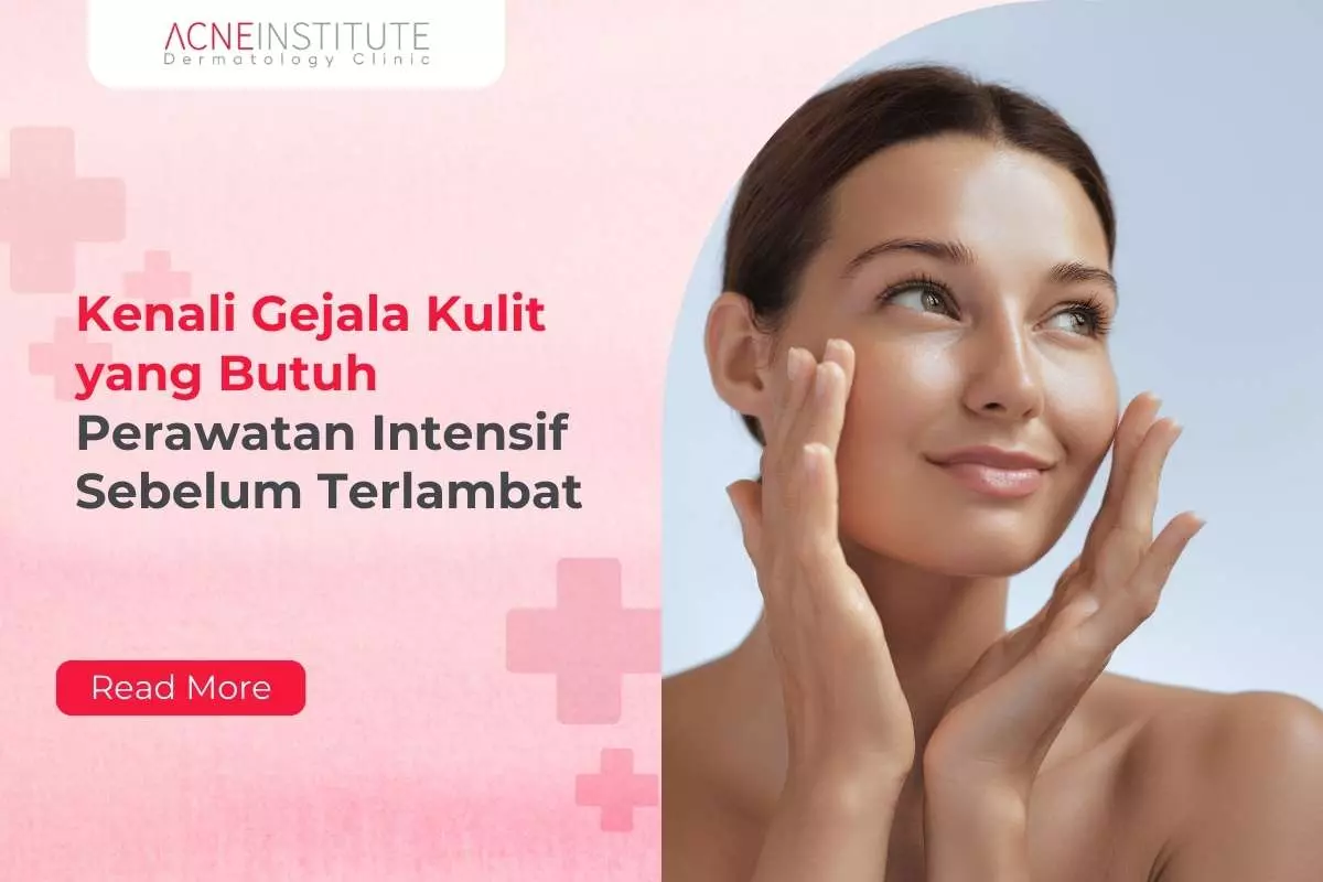 Yuk, Kenali Gejala Kulit yang Butuh Perawatan Intensif Sebelum Terlambat