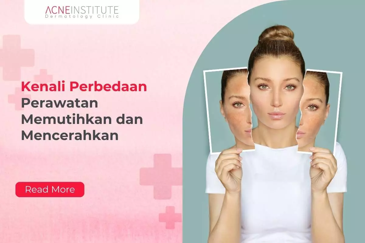 Biar Nggak Salah Pilih! Kenali Perbedaan Perawatan Memutihkan dan Mencerahkan