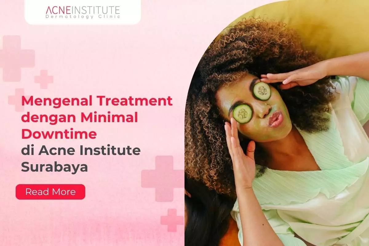 Mengenal Treatment dengan Minimal Downtime di Acne Institute Surabaya