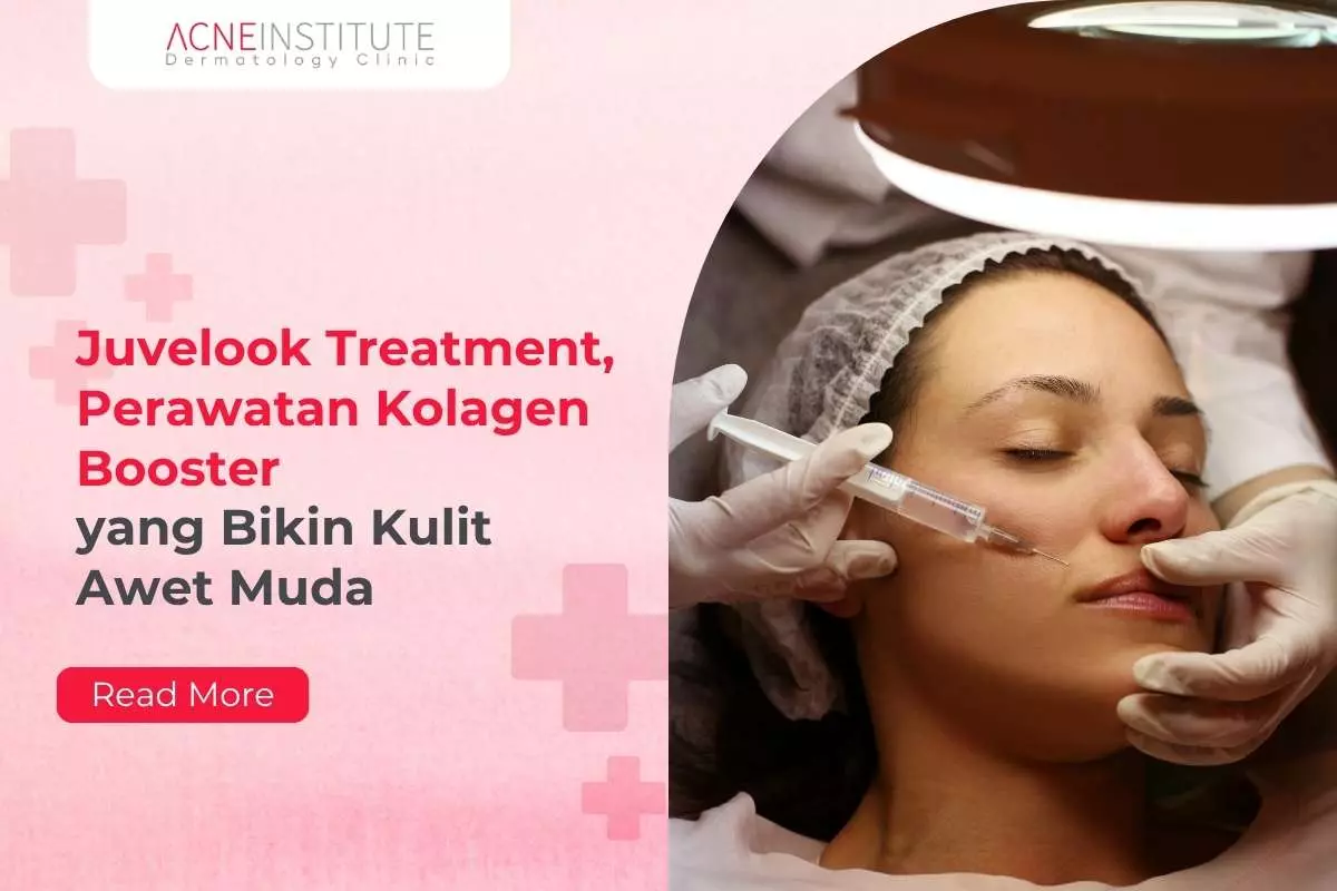 Juvelook Treatment, Perawatan Kolagen Booster yang Bikin Kulit Awet Muda