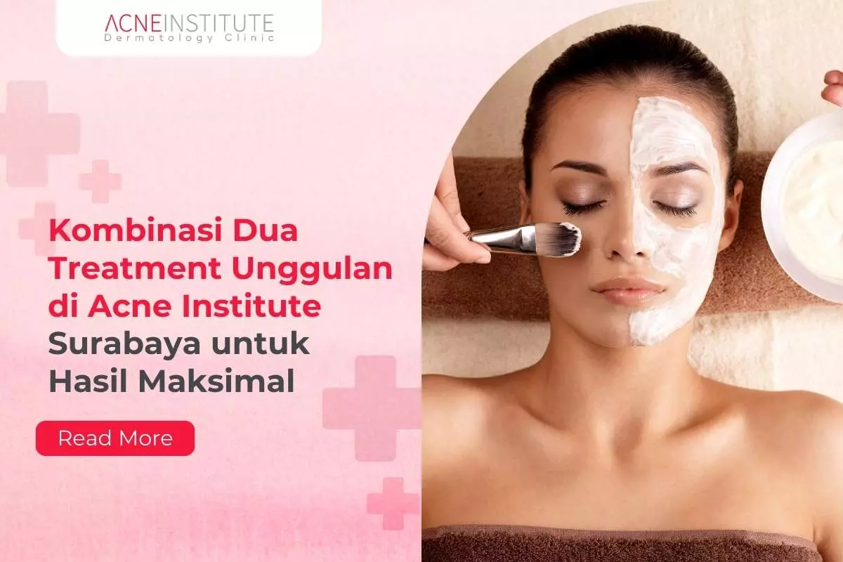 Kombinasi Dua Treatment Unggulan di Acne Institute Surabaya untuk Hasil Maksimal