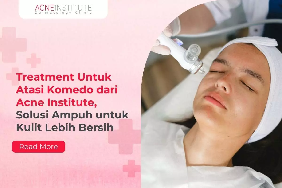 Treatment Untuk Atasi Komedo dari Acne Institute, Solusi Ampuh untuk Kulit Lebih Bersih