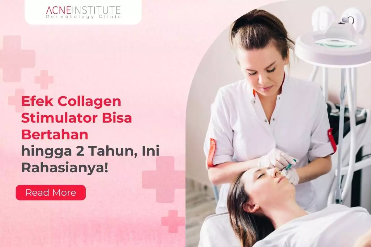 Efek Collagen Stimulator Bisa Bertahan hingga 2 Tahun, Ini Rahasianya!