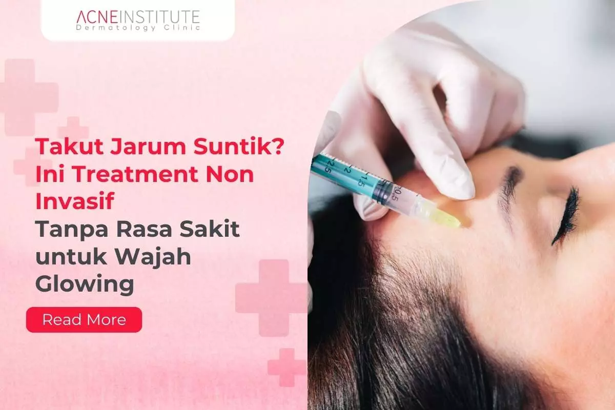 Takut Jarum Suntik? Ini Treatment Non Invasif Tanpa Rasa Sakit untuk Wajah Glowing