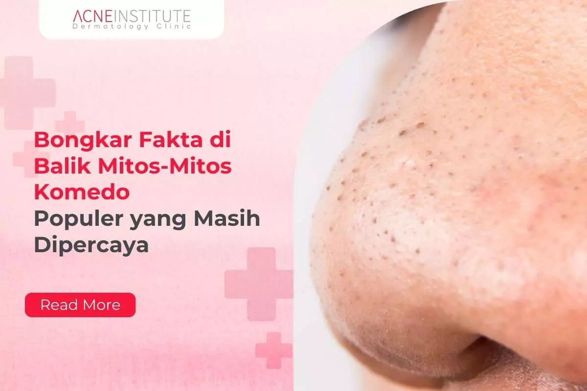 Bongkar Fakta di Balik Mitos-Mitos Komedo Populer yang Masih Dipercaya