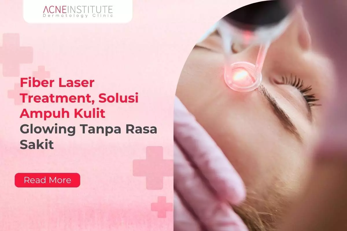 Fiber Laser Treatment, Solusi Ampuh Kulit Glowing Tanpa Rasa Sakit
