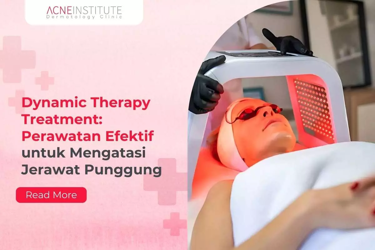 Dynamic Therapy Treatment: Perawatan Efektif untuk Mengatasi Jerawat Punggung