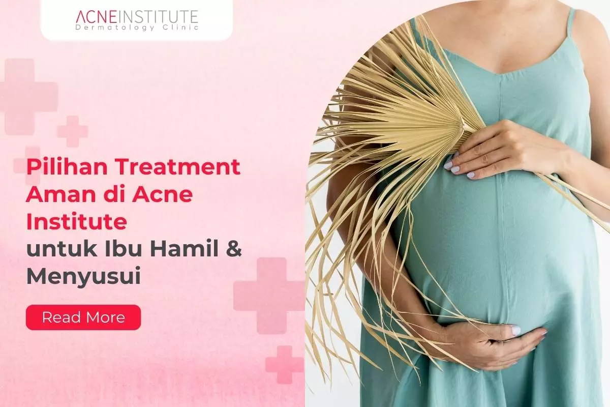 Pilihan Treatment Aman di Acne Institute untuk Ibu Hamil & Menyusui