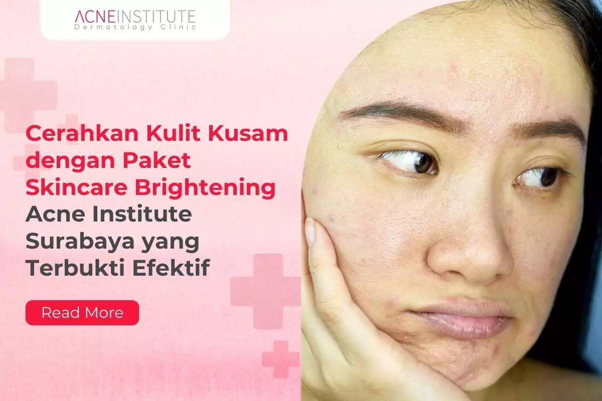 Cerahkan Kulit Kusam dengan Paket Skincare Brightening Acne Institute Surabaya yang Terbukti Efektif