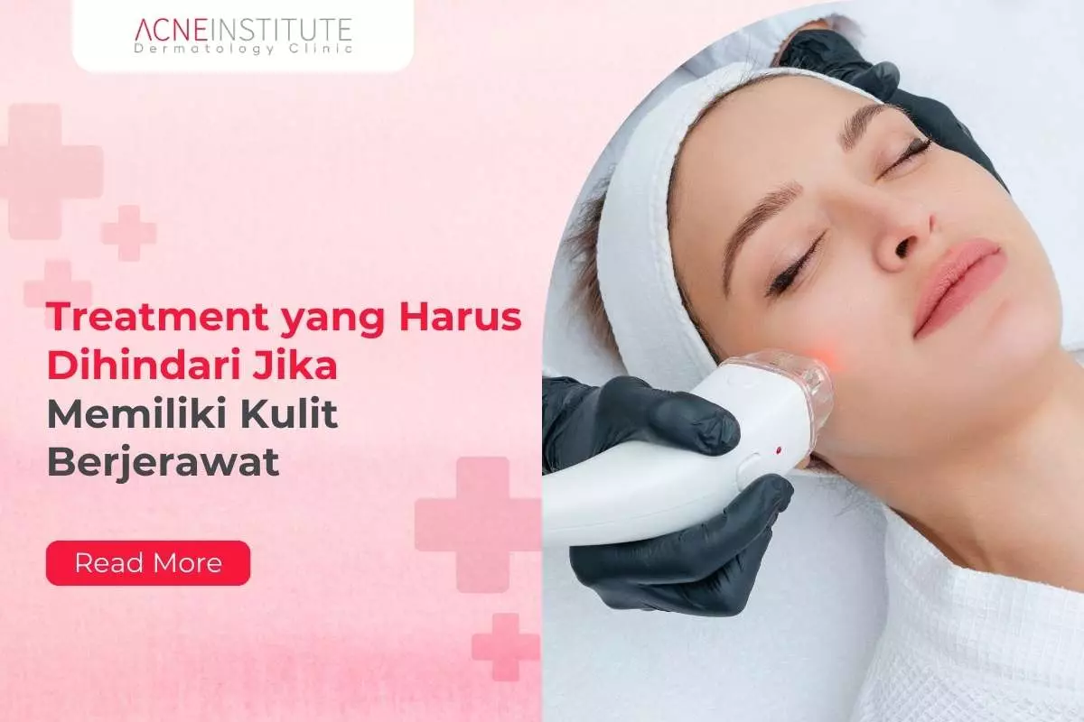 Treatment yang Harus Dihindari Jika Memiliki Kulit Berjerawat