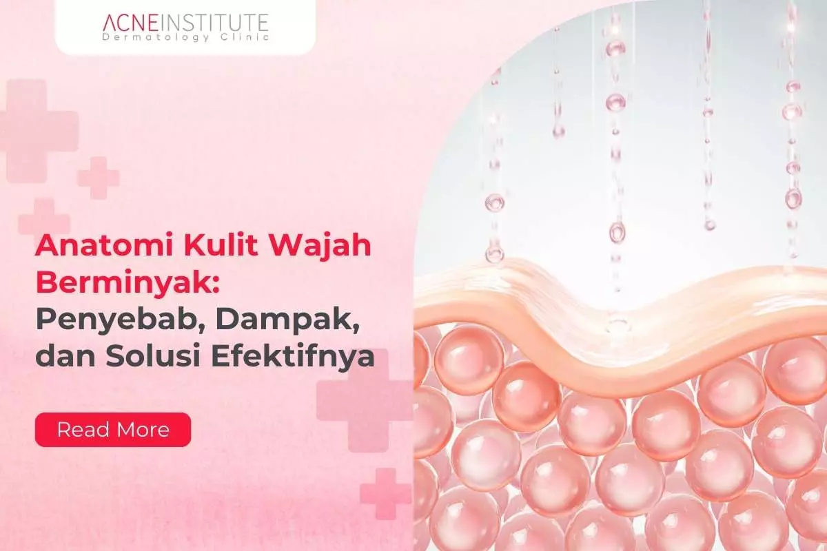 Anatomi Kulit Wajah Berminyak: Penyebab, Dampak, dan Solusi Efektifnya