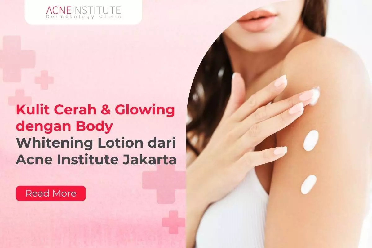 Kulit Cerah & Glowing dengan Body Whitening Lotion dari Acne Institute Jakarta