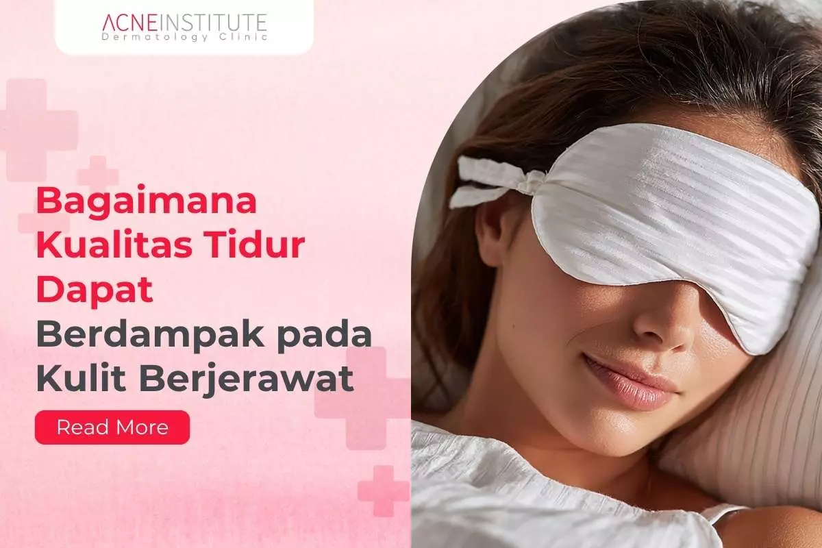 Bagaimana Kualitas Tidur Dapat Berdampak pada Kulit Berjerawat