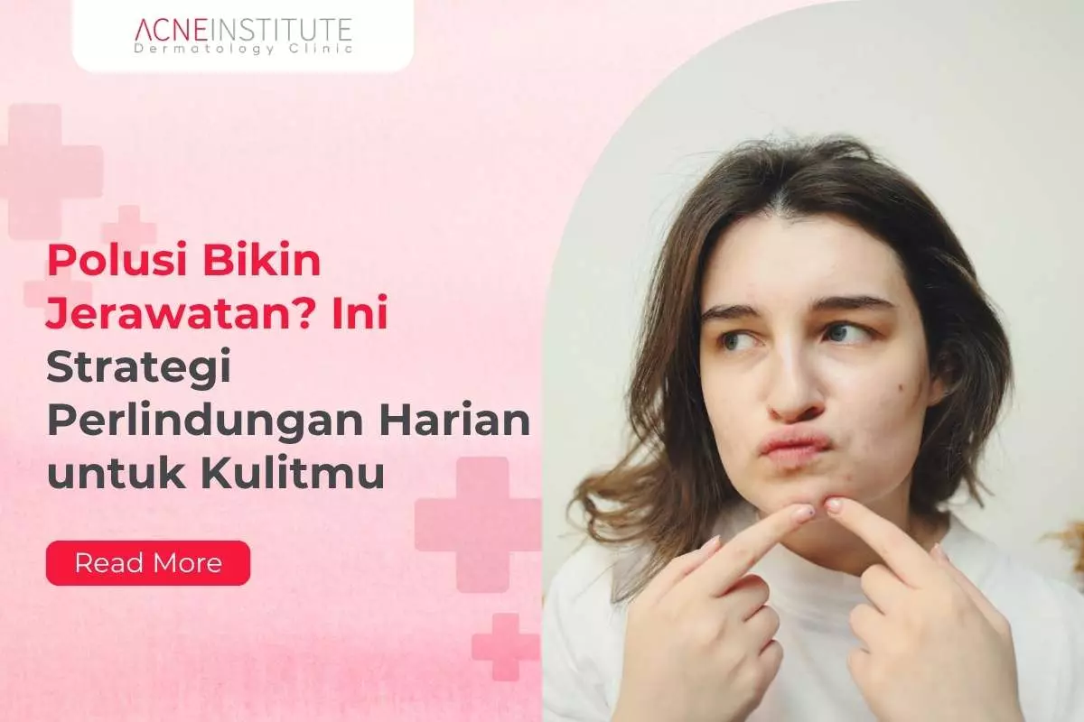 Polusi Bikin Jerawatan? Ini Strategi Perlindungan Harian untuk Kulitmu