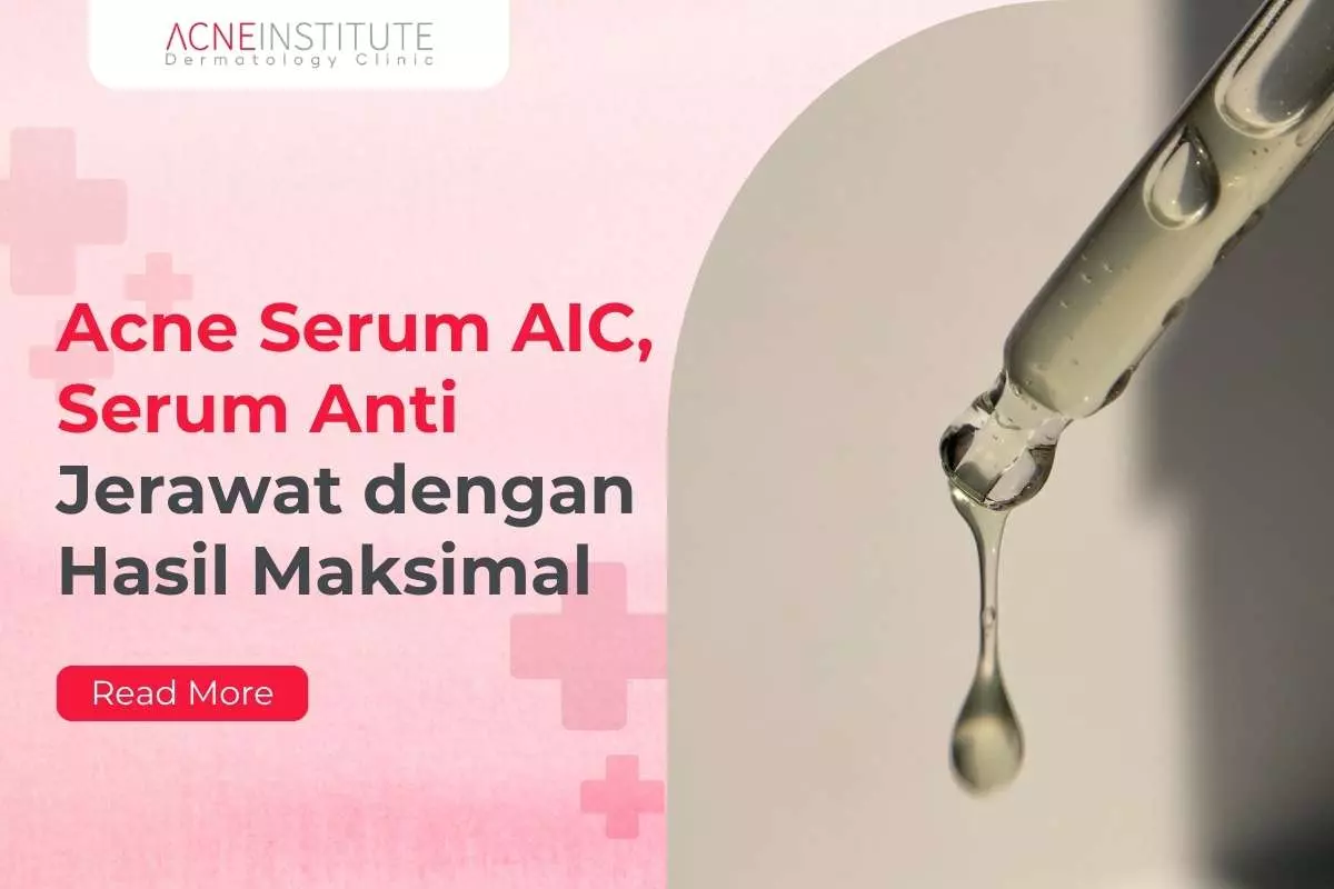 Acne Serum AIC, Serum Anti Jerawat dengan Hasil Maksimal