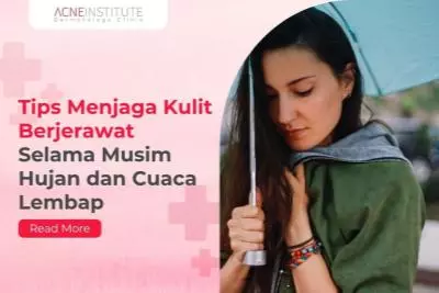 Tips Menjaga Kulit Berjerawat Selama Musim Hujan dan  Cuaca Lembap