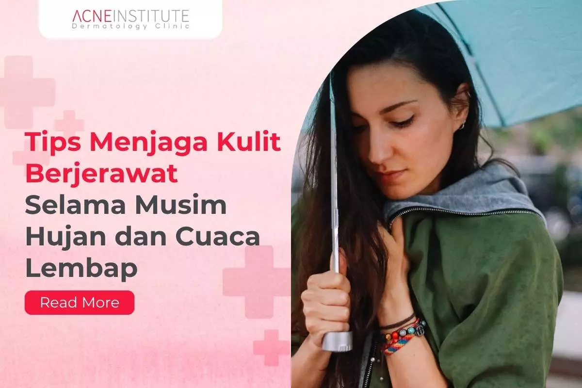 Tips Menjaga Kulit Berjerawat Selama Musim Hujan dan  Cuaca Lembap