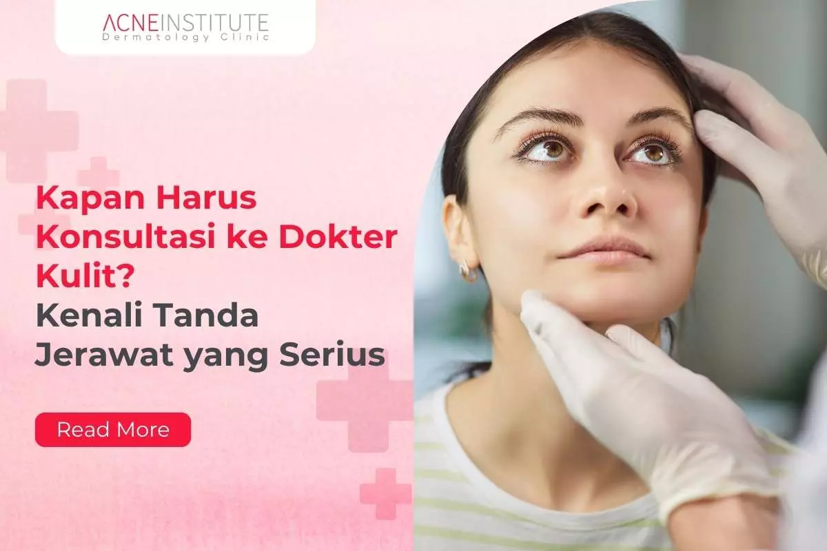 Kapan Harus Konsultasi ke Dokter Kulit? Kenali Tanda Jerawat yang Serius