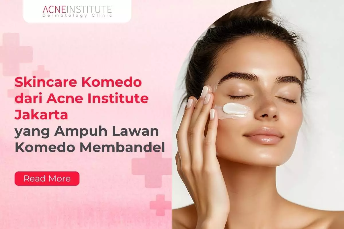 Skincare Komedo dari Acne Institute Jakarta yang Ampuh Lawan Komedo Membandel