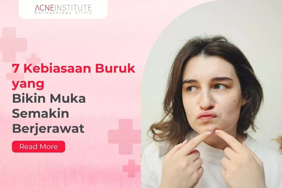 7 Kebiasaan Buruk yang Bikin Muka Semakin Berjerawat