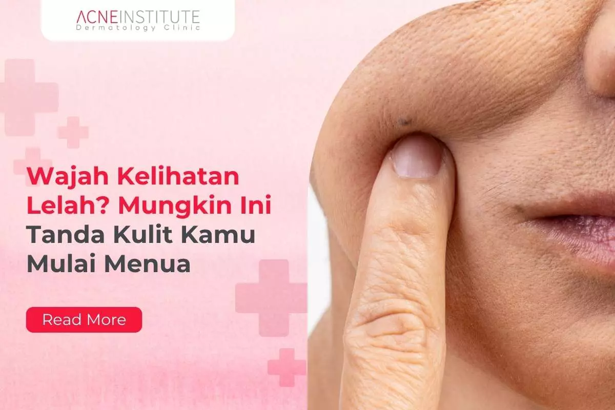 Wajah Kelihatan Lelah? Mungkin Ini Tanda Kulit Kamu Mulai Menua