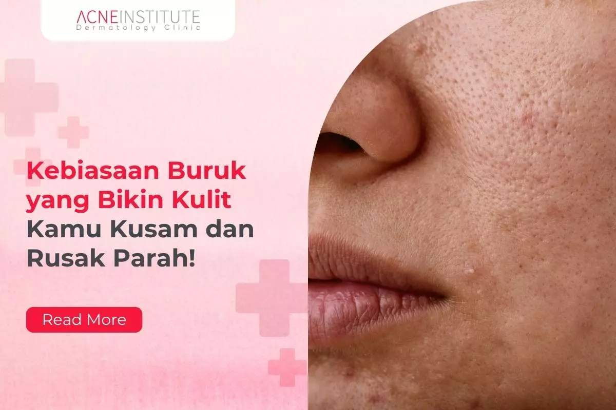 Kebiasaan Buruk yang Bikin Kulit Kamu Kusam dan Rusak Parah!