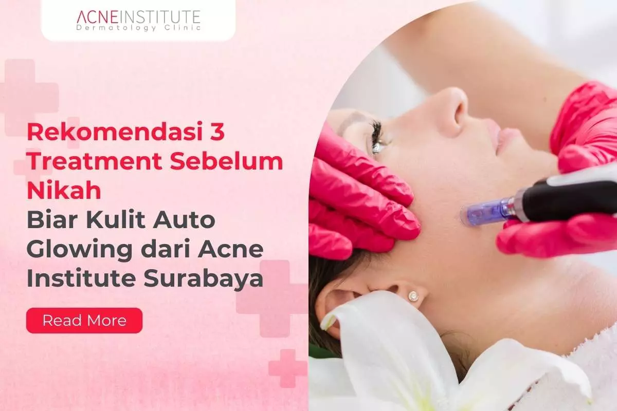 Rekomendasi 3 Treatment Sebelum Nikah Biar Kulit Auto Glowing dari Acne Institute Surabaya