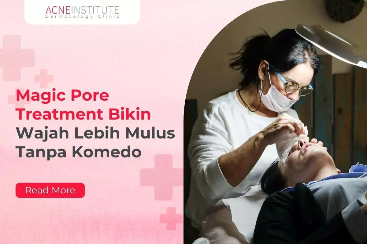 Magic Pore Treatment Bikin Wajah Lebih Mulus Tanpa Komedo