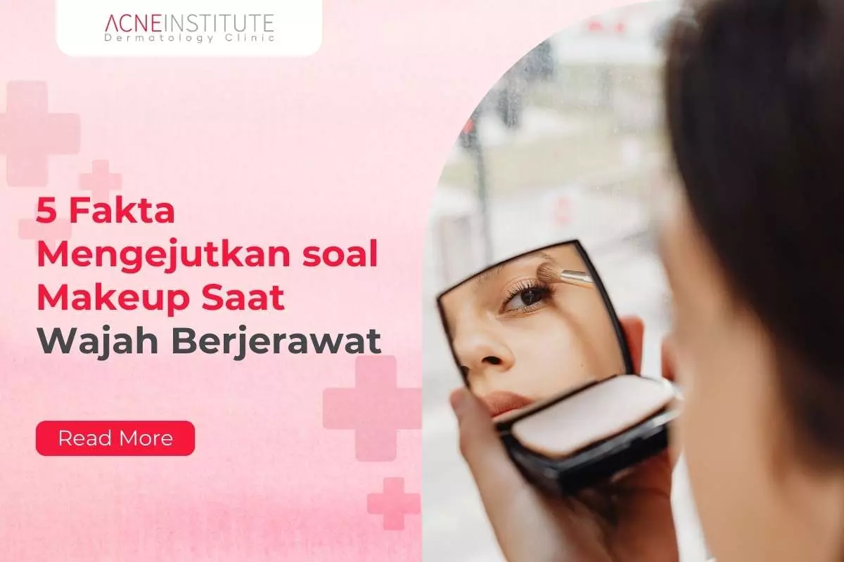 5 Fakta Mengejutkan soal Makeup Saat Wajah Berjerawat yang Perlu diKetahui