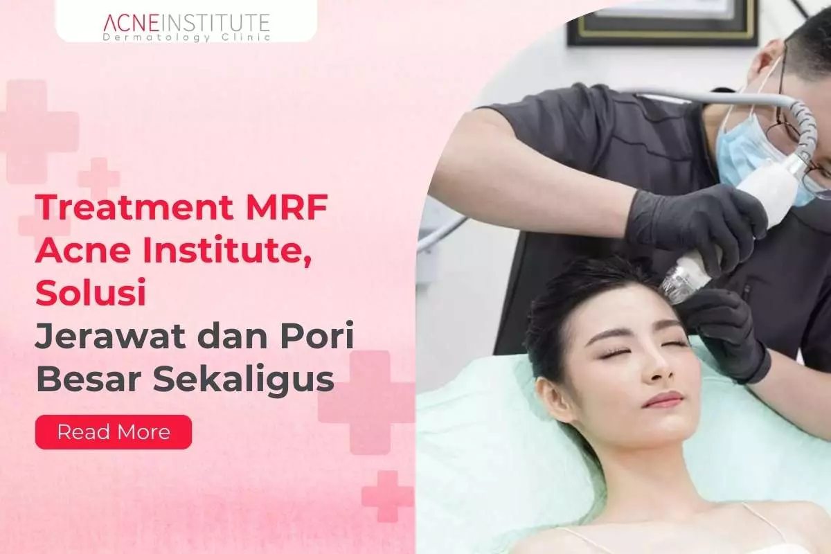 Treatment MRF Acne Institute, Solusi Jerawat dan Pori Besar Sekaligus