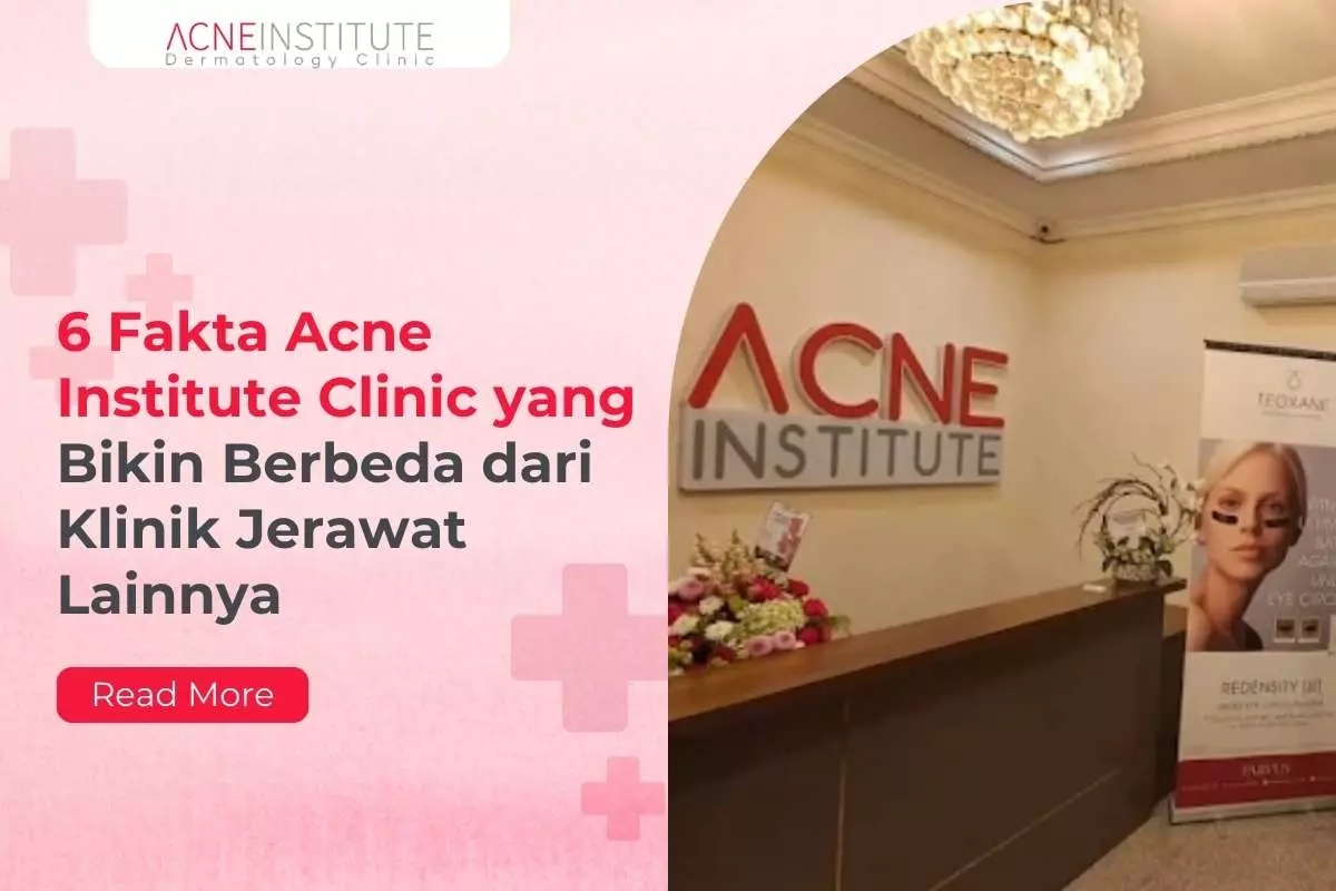 6 Fakta Acne Institute Clinic yang Bikin Berbeda dari Klinik Jerawat Lainnya