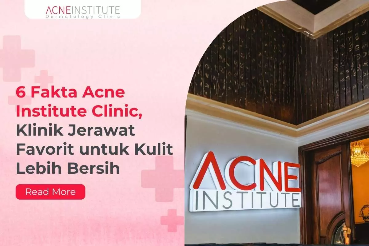 6 Fakta Acne Institute Clinic, Klinik Jerawat Favorit untuk Kulit Lebih Bersih